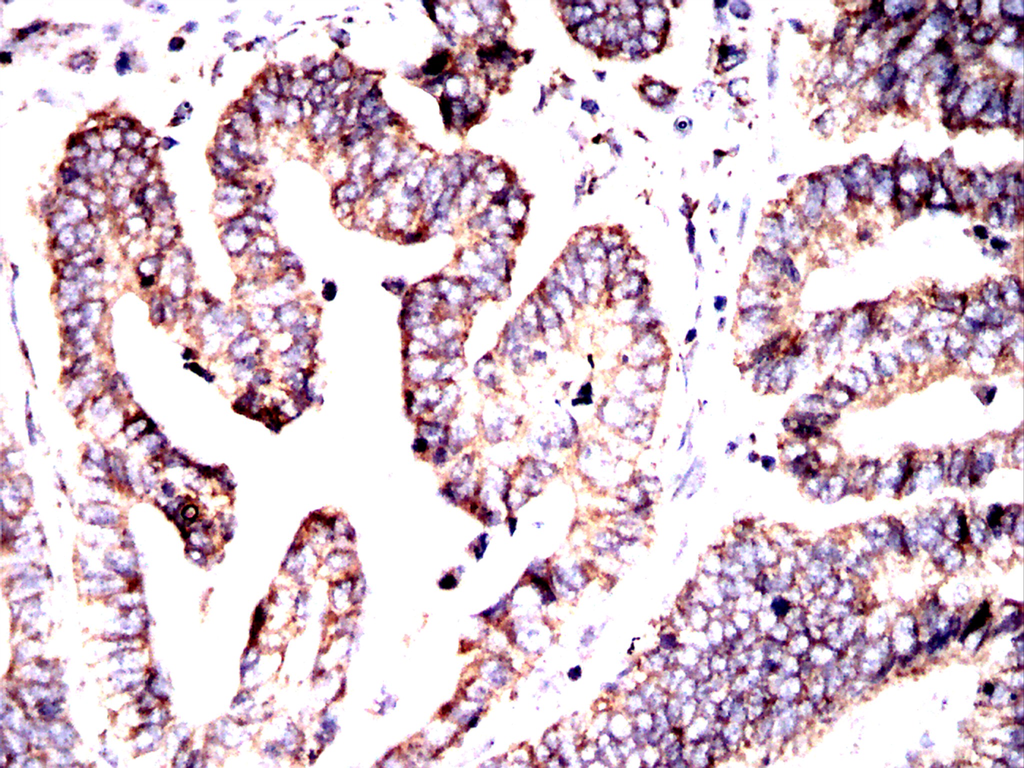 IHC